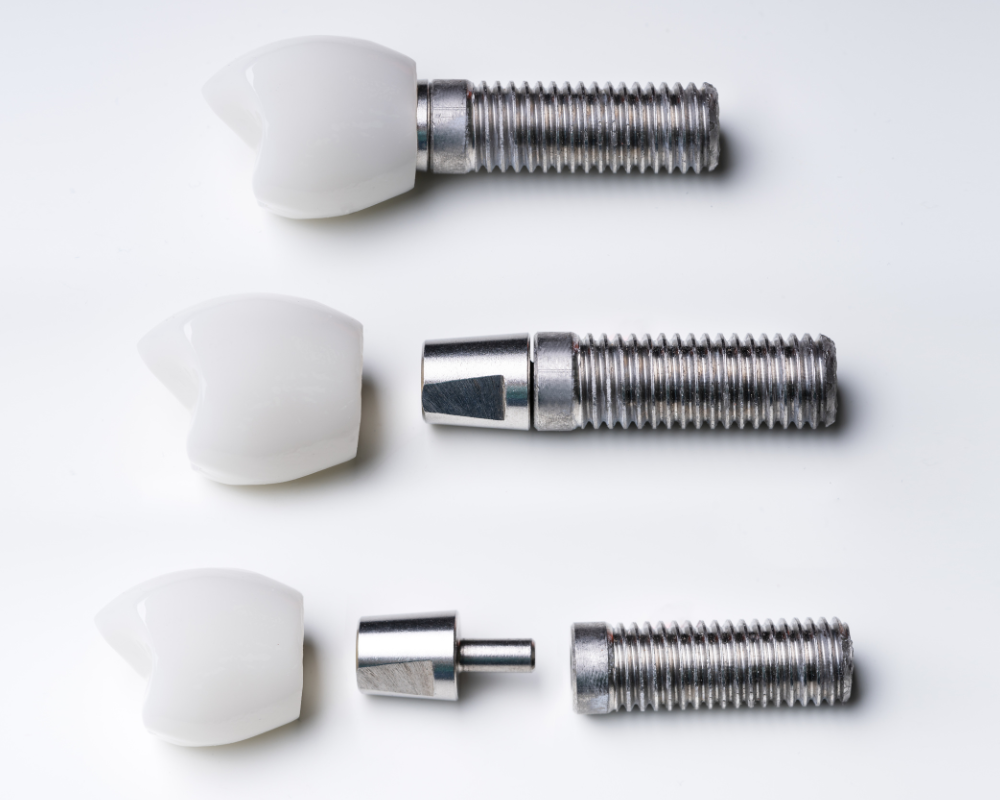 インプラントメーカーへのこだわり